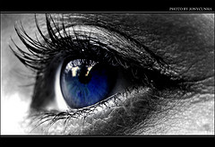 Is Lasik Surgery Worth It
